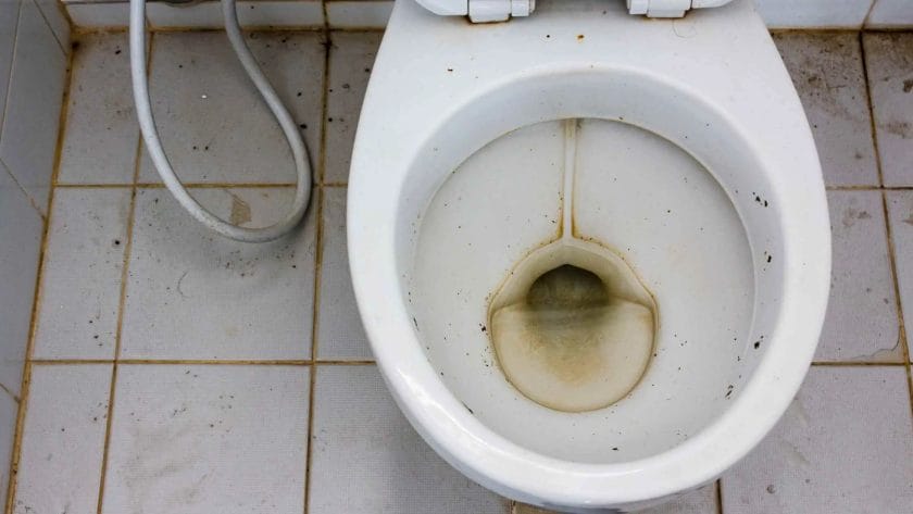 Photo of a dirty toilet with rings.